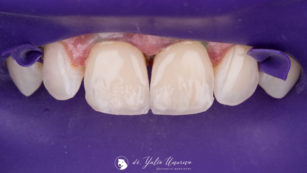 883F6177-429C-4B5F-A865-52E6192DD475