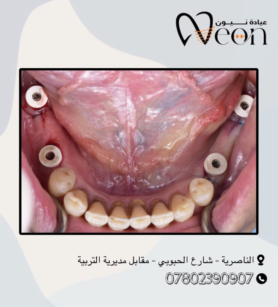 8F98C07C-AB41-41E3-8C9C-A1842DDC2A83