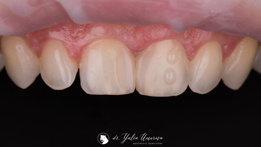 9DE63C19-C4A9-4B14-BEEC-12E8307997CB