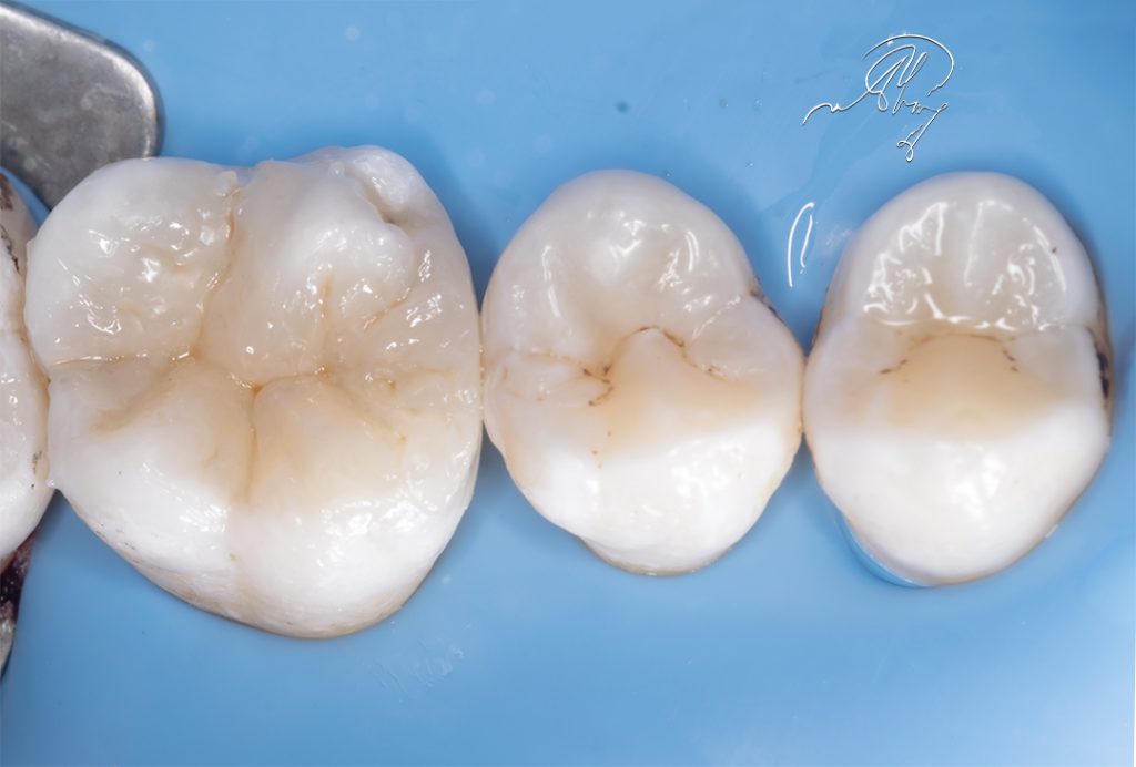 A905DA5A-0C79-452A-AF00-7B2CA29E2476