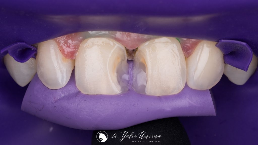 BCE93439-9614-4B7B-A195-71A3FEF9E619