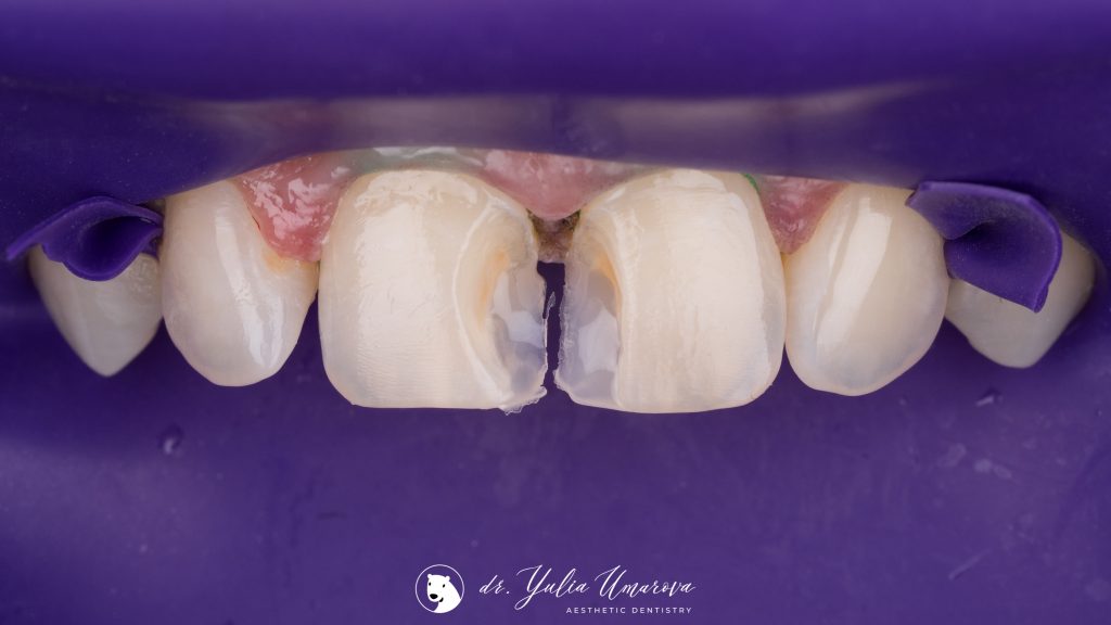 C485832B-54C1-461B-A600-CF9AB5361258