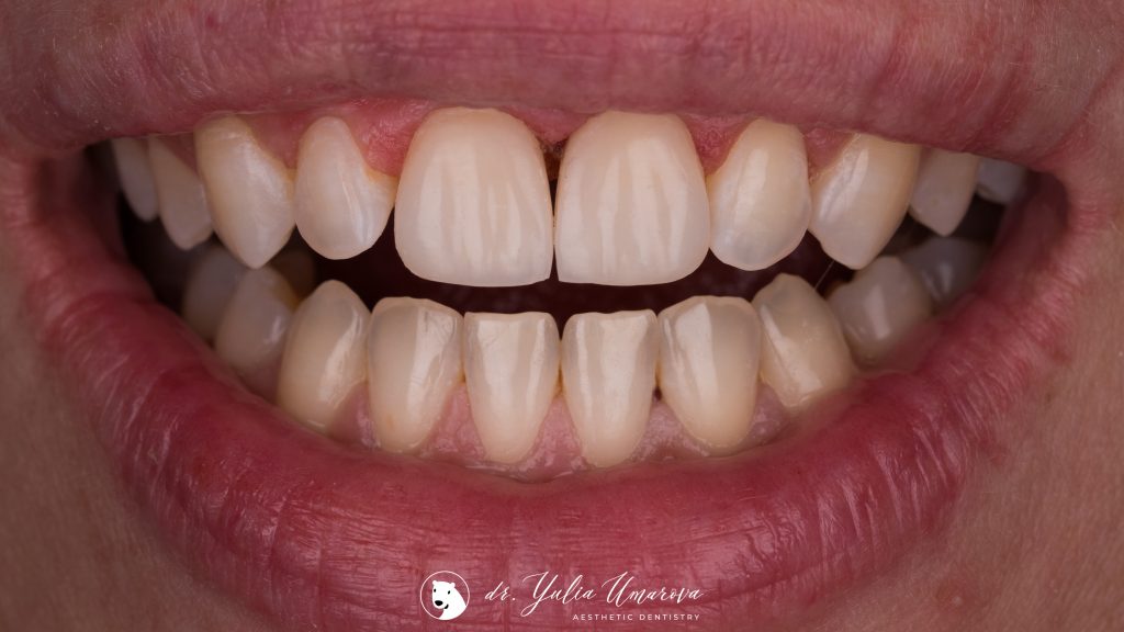 D54A221E-43D5-4B82-AEA7-1CAE5A3EC89E