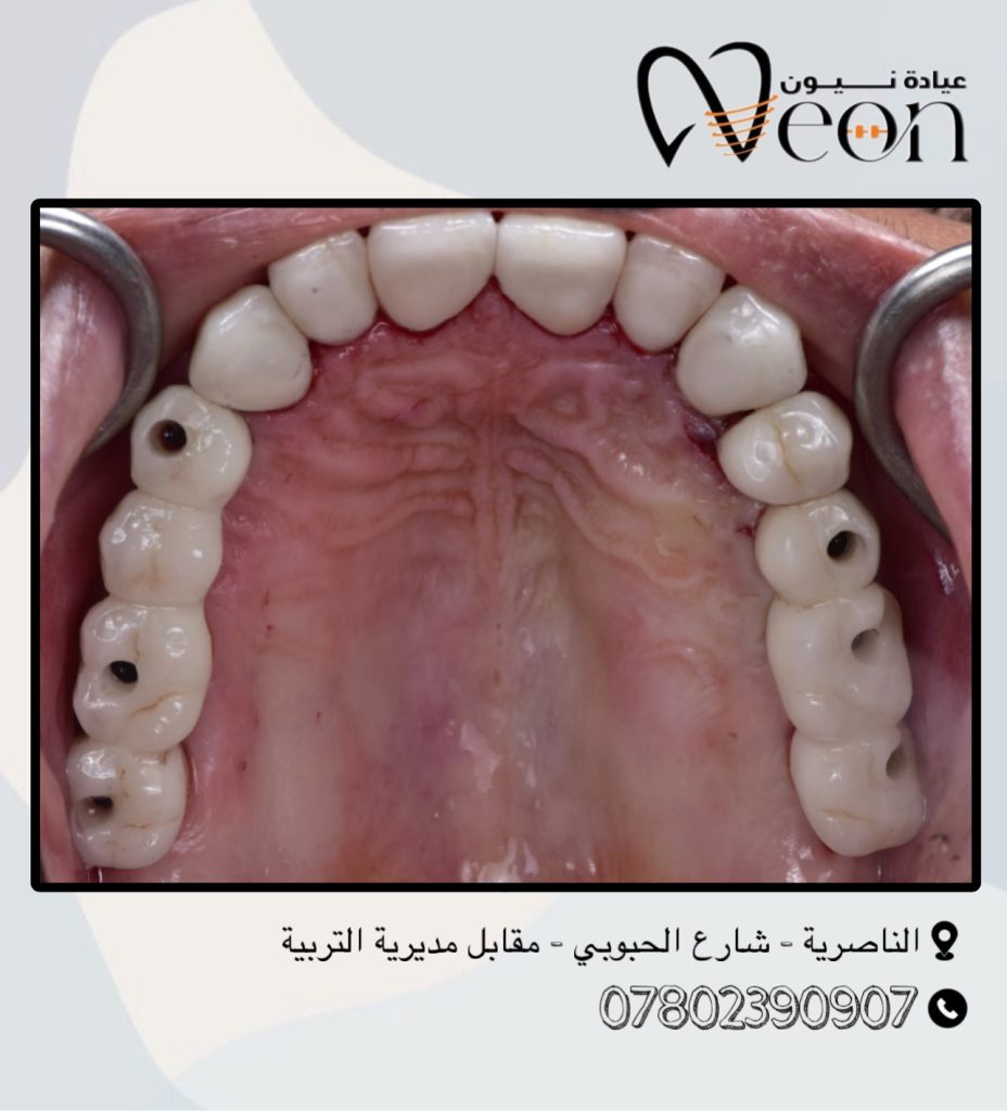 D8F586DC-7FC6-401E-997D-E3A02121A55C