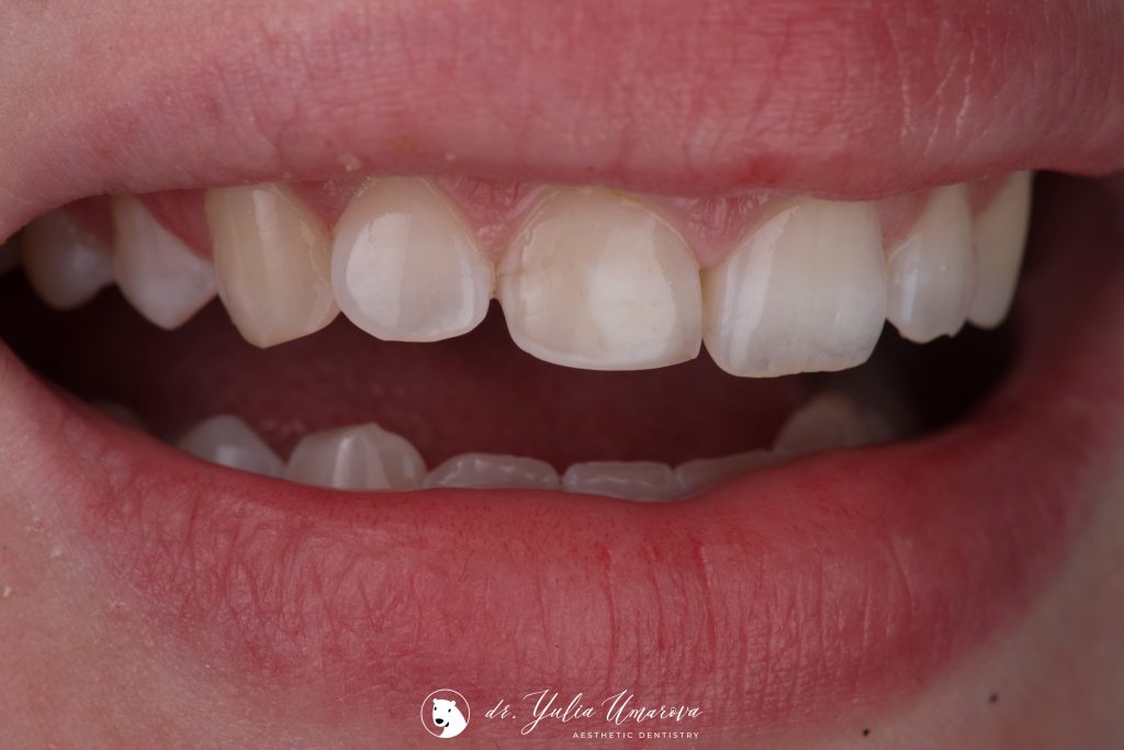 D91B0EDE-514E-445E-8977-2CD0FC4664D4