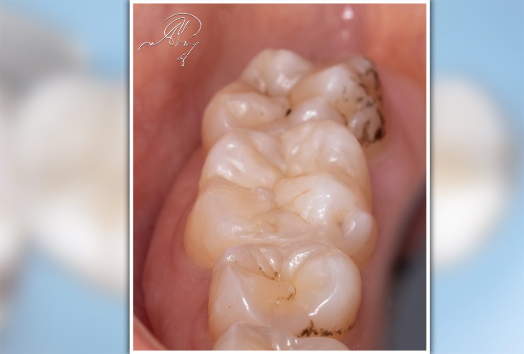 D9337C17-67C6-4B51-8F76-CC9CD720AD8D