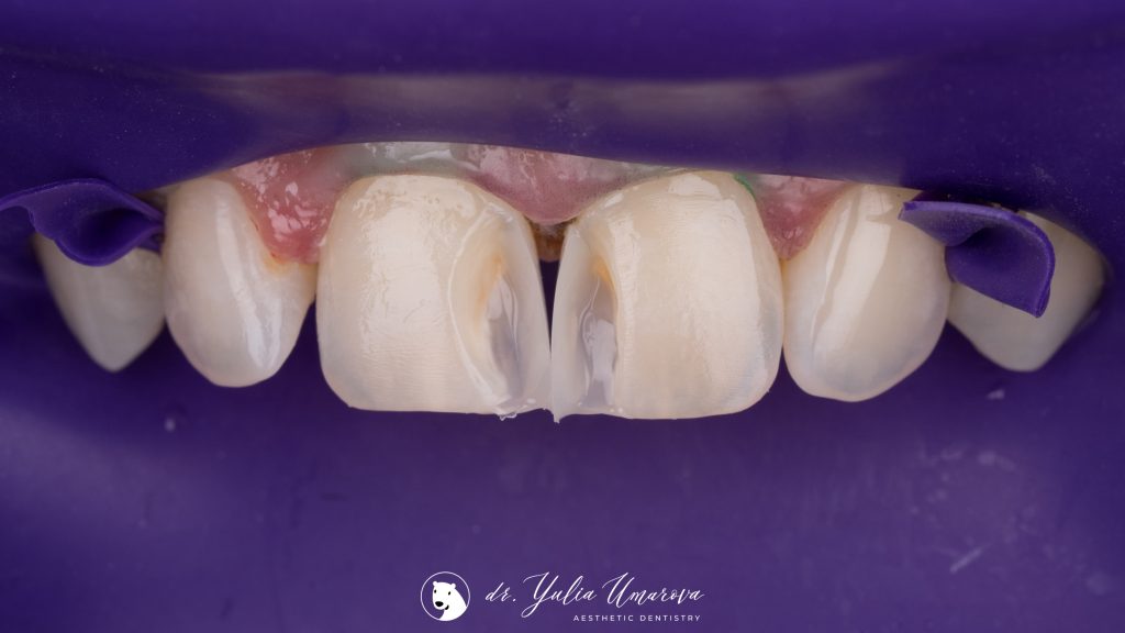 EE53904F-D715-4316-B572-C38C43308BB2