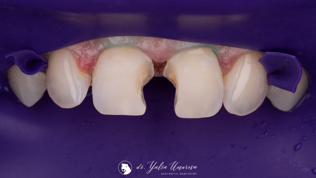 F1D62F87-BFB9-4287-A2A7-437099E8AEF8