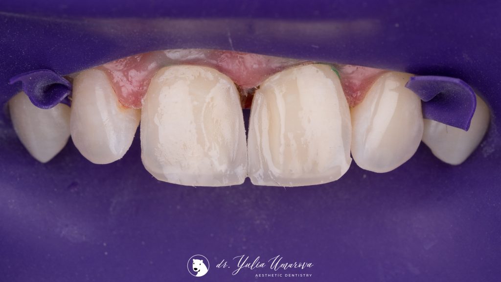 F211336F-1157-415B-A17D-D74877100C24