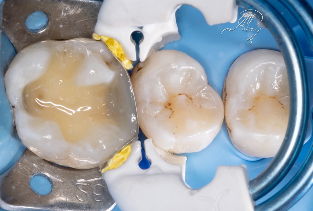 FB48B06C-3616-4414-9033-AFAFE7E4AE41