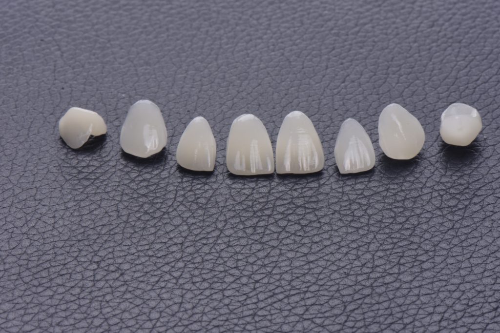 veneers and crowns