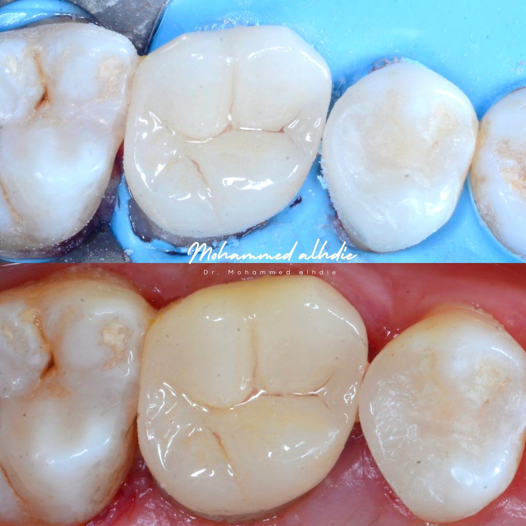 Picsart_24-10-18_20-49-51-509