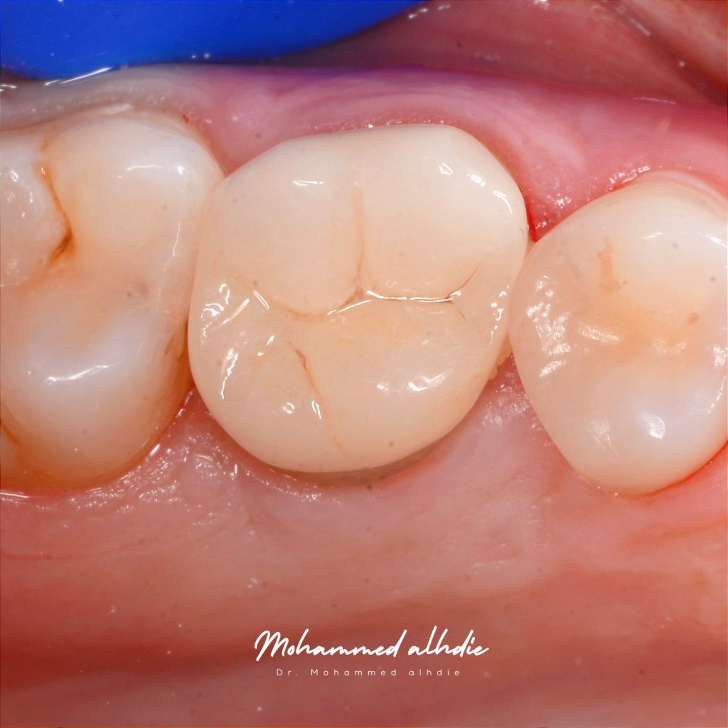 Picsart_25-01-04_18-42-22-804