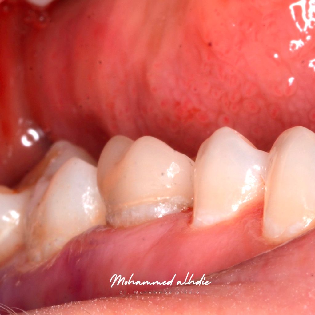 Picsart_25-01-04_18-43-06-473