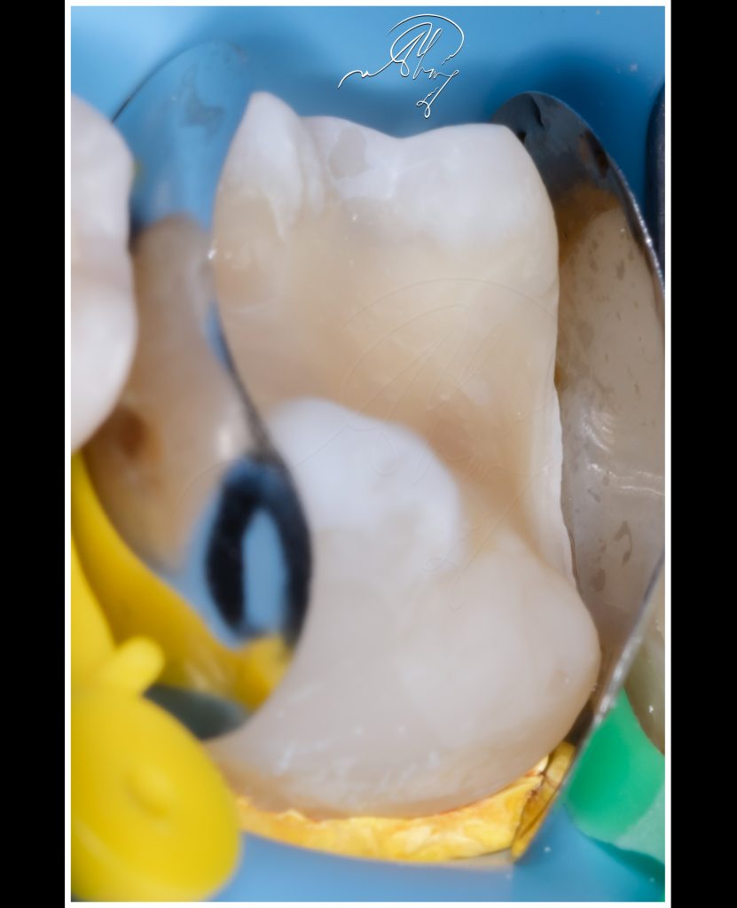 44B391B2-145A-4DEA-A550-99AEFBFDBE78