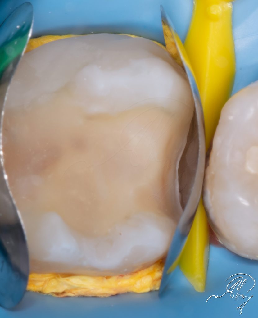 4CC61E26-D4A0-4529-9909-D8C088DE6E08