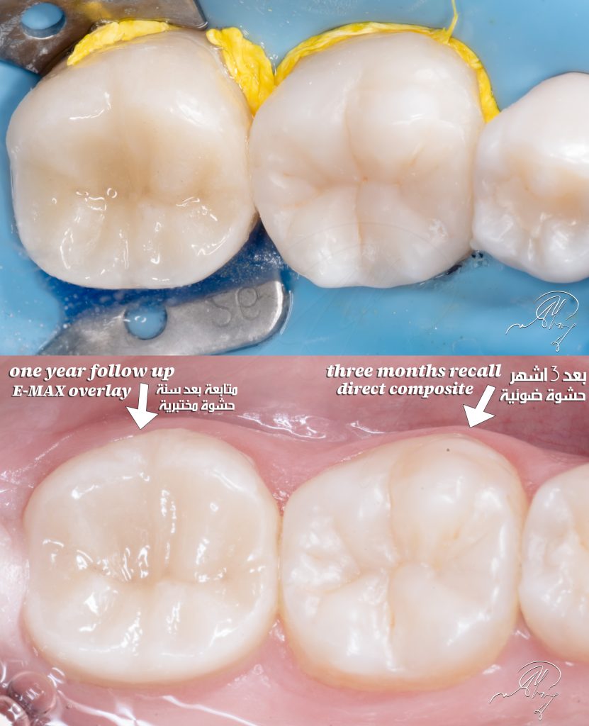 711EF0ED-1352-44F7-AA40-9EA47953DAEF