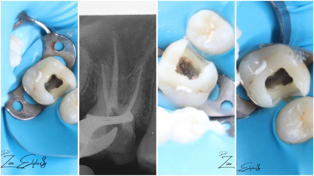 87166E4E-4A30-4732-9954-5AFA8BF1E3E9