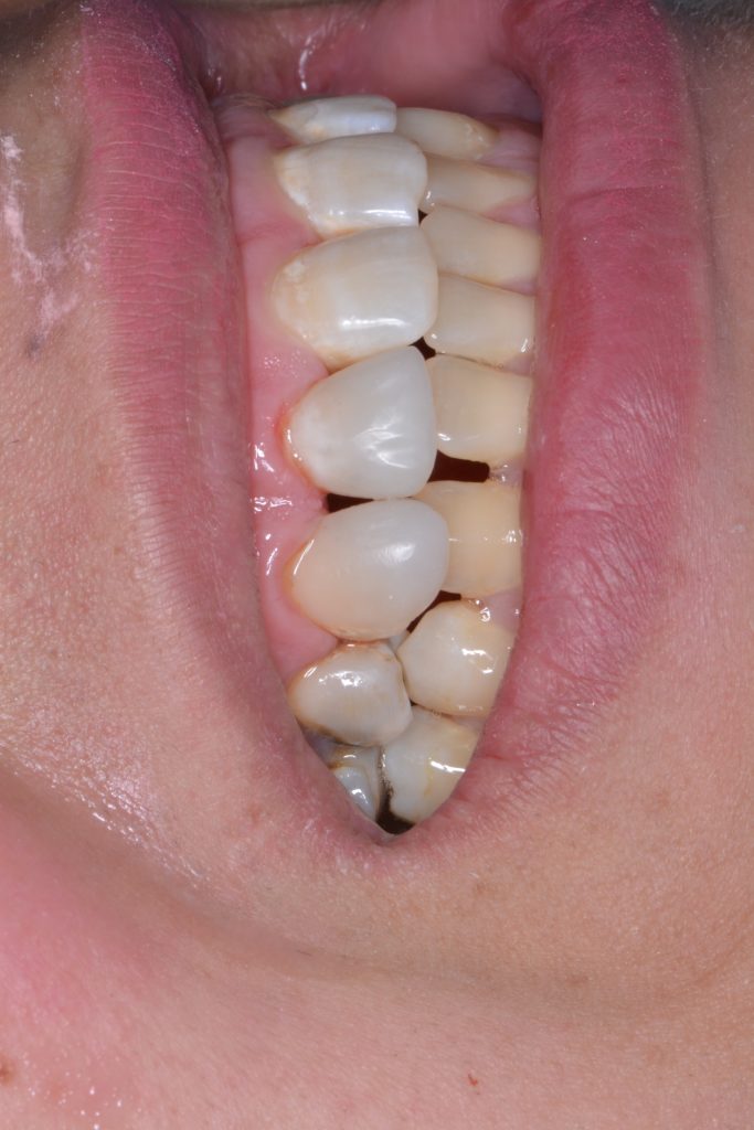 885ECC0A-57E4-4F22-B621-6D9C85787BFD