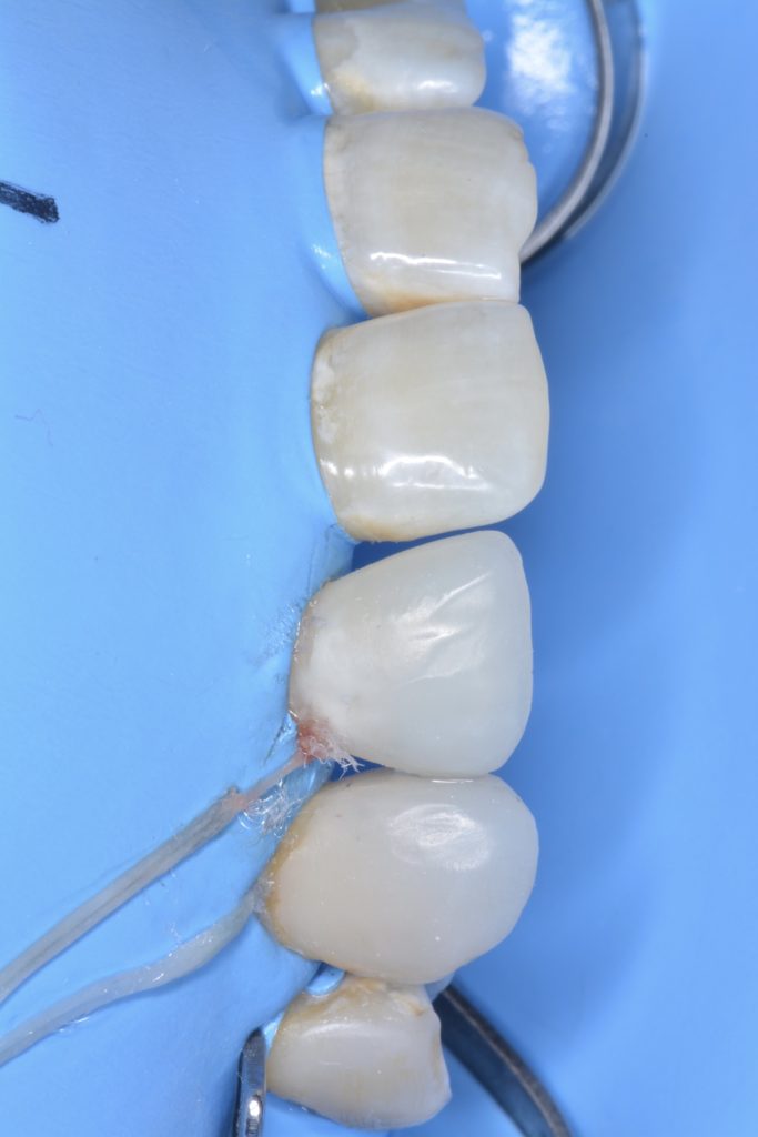 907CE18D-4A94-49DB-AD8F-51E119EC66A1