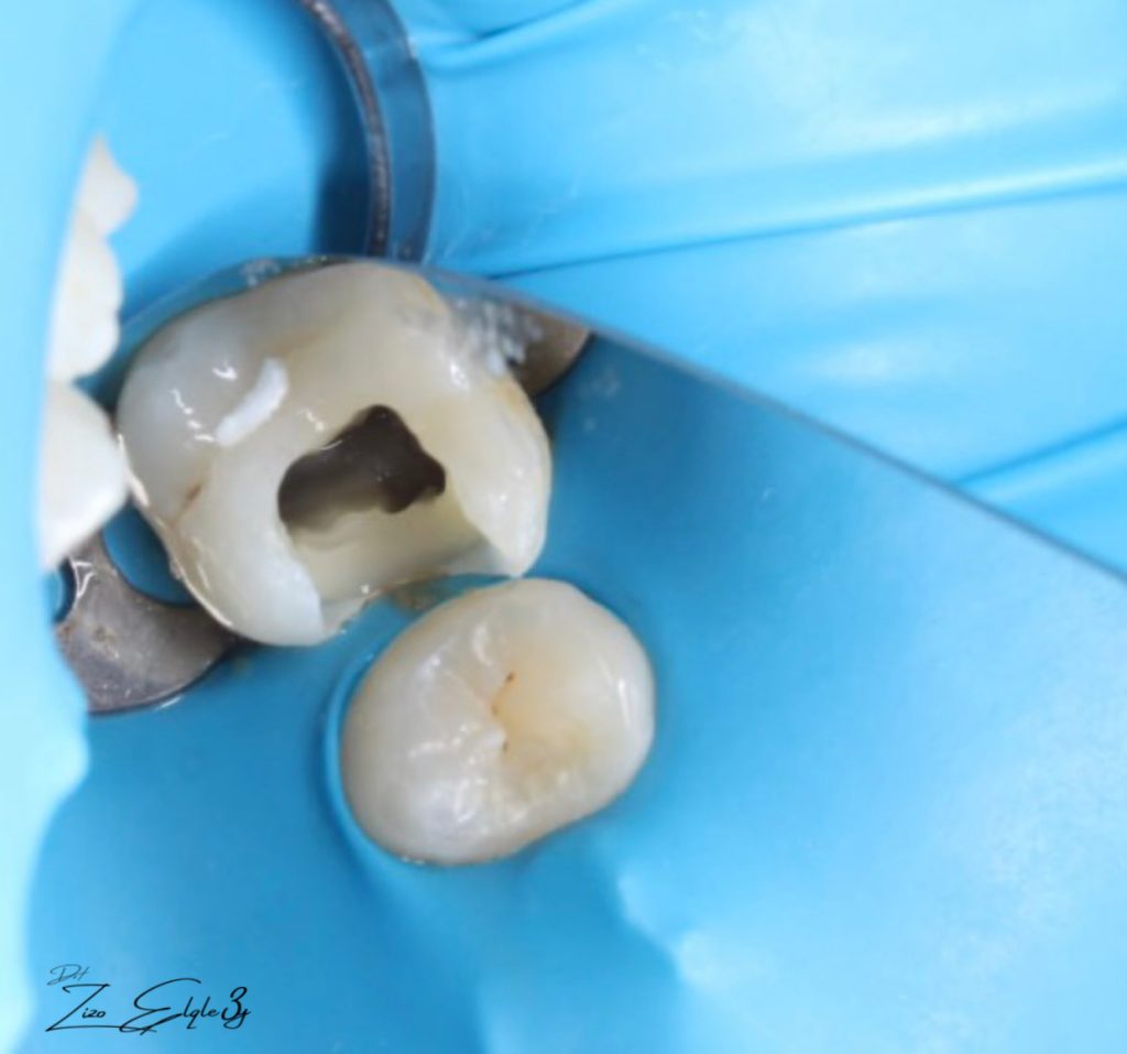 F2F0DAC6-516D-485F-AB0D-9A6A2E1B54E4