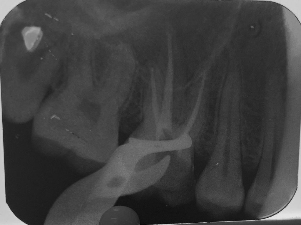 F31114EF-416D-46B7-A45C-3CDAFBD096BD