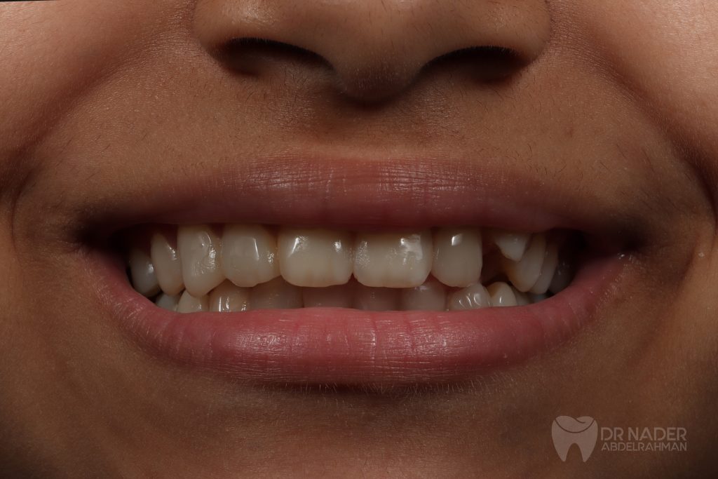 GridArt_20241223_205734211