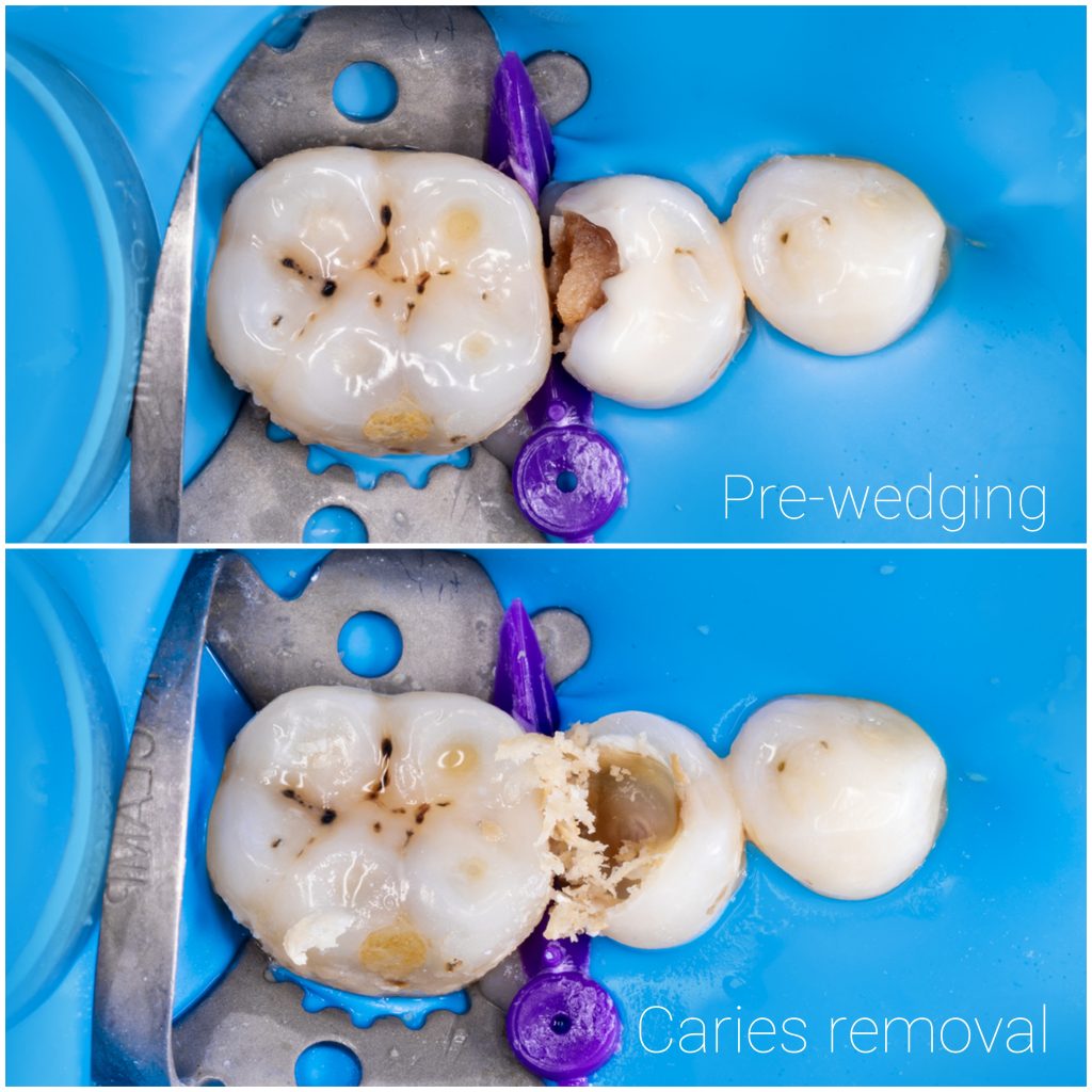 Picsart_24-11-29_11-39-36-403