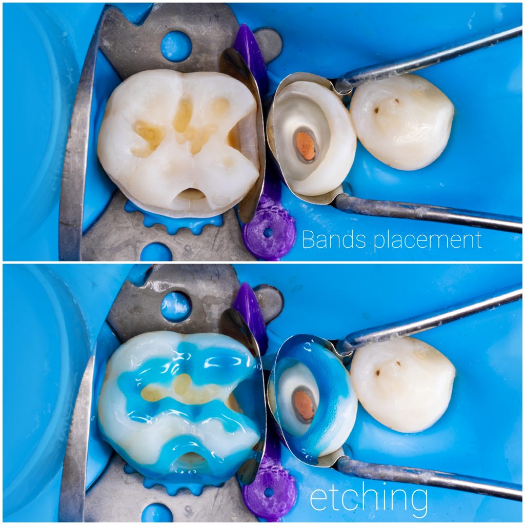 Picsart_24-11-29_11-50-49-832