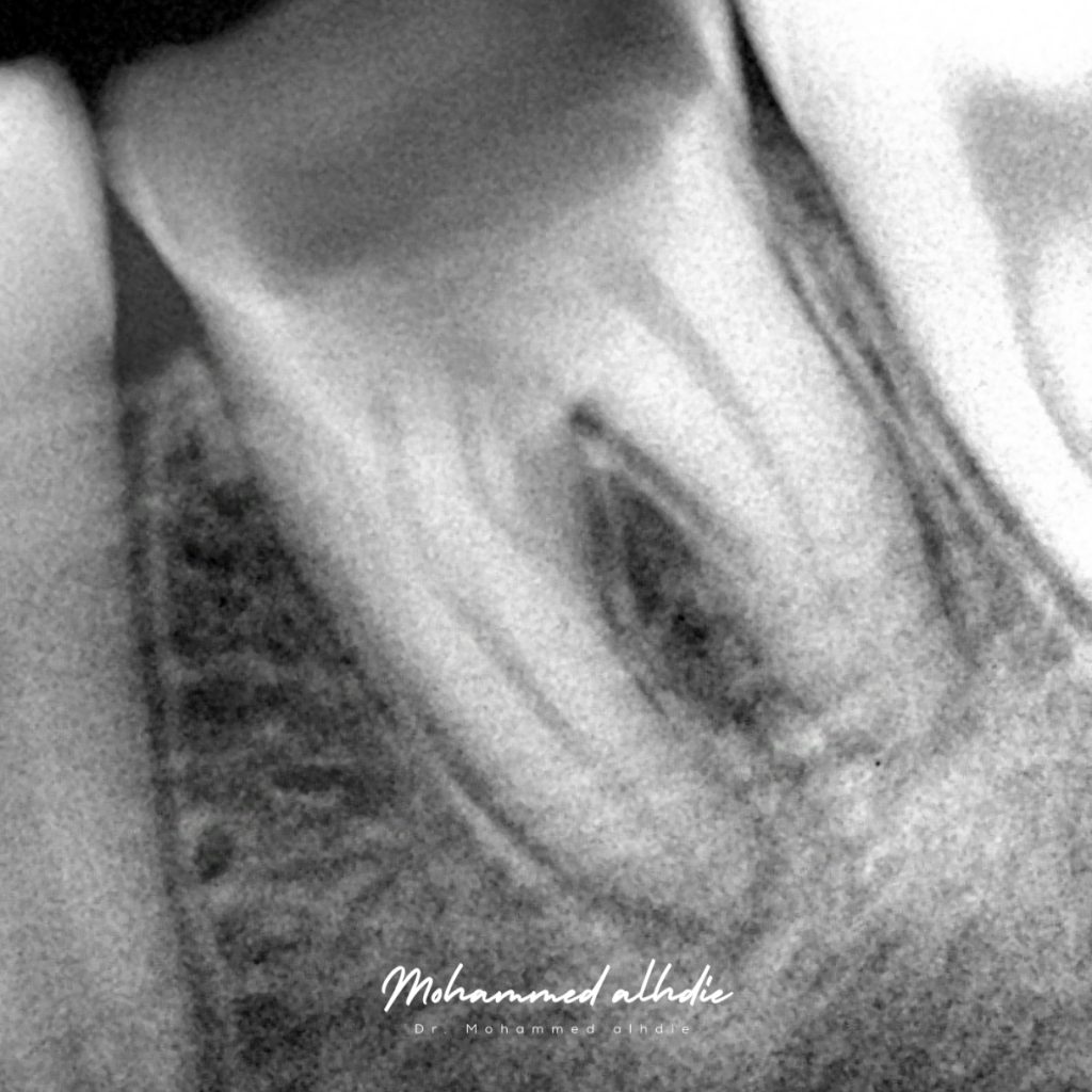 Picsart_24-12-26_23-37-52-312