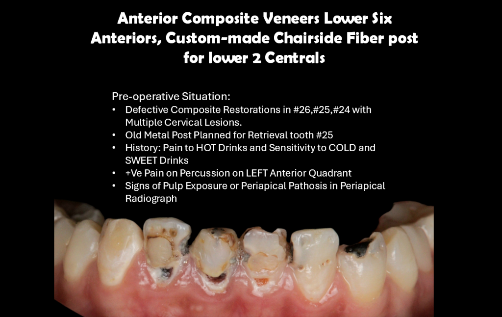 Lower Anteriors planning