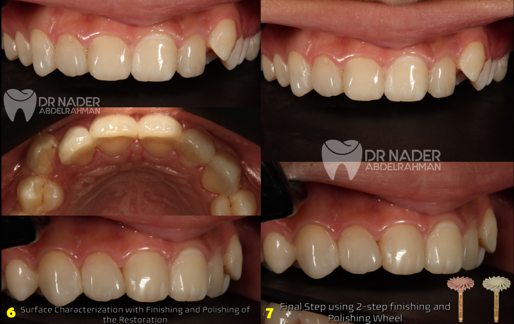 Surface Characterization and Polishing Step