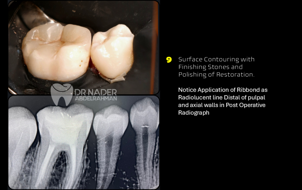 Post-Op Radiograph