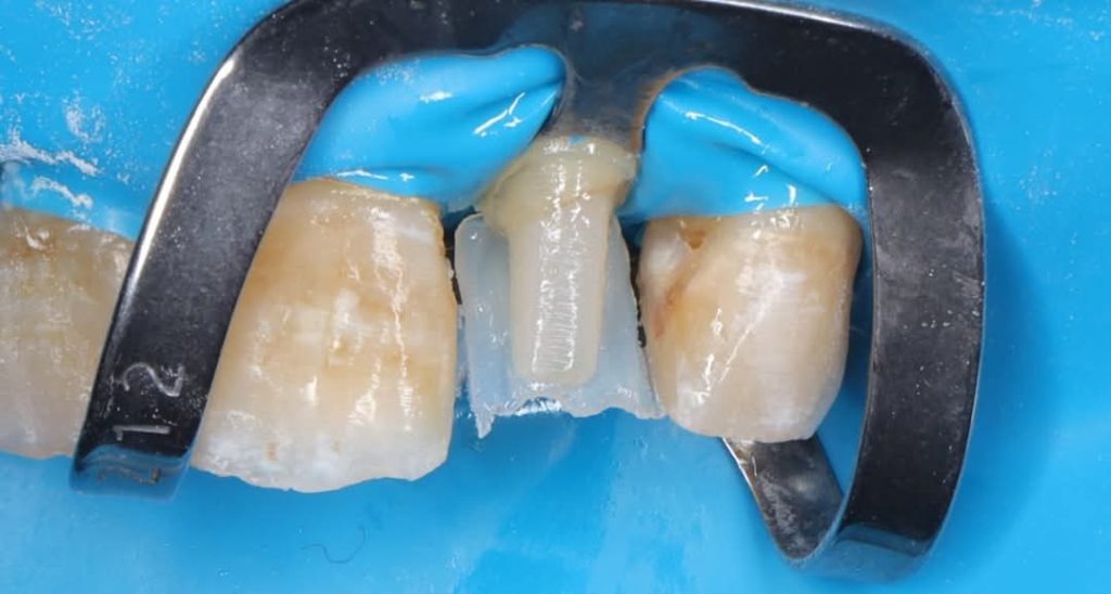 inbound1530598737652028760