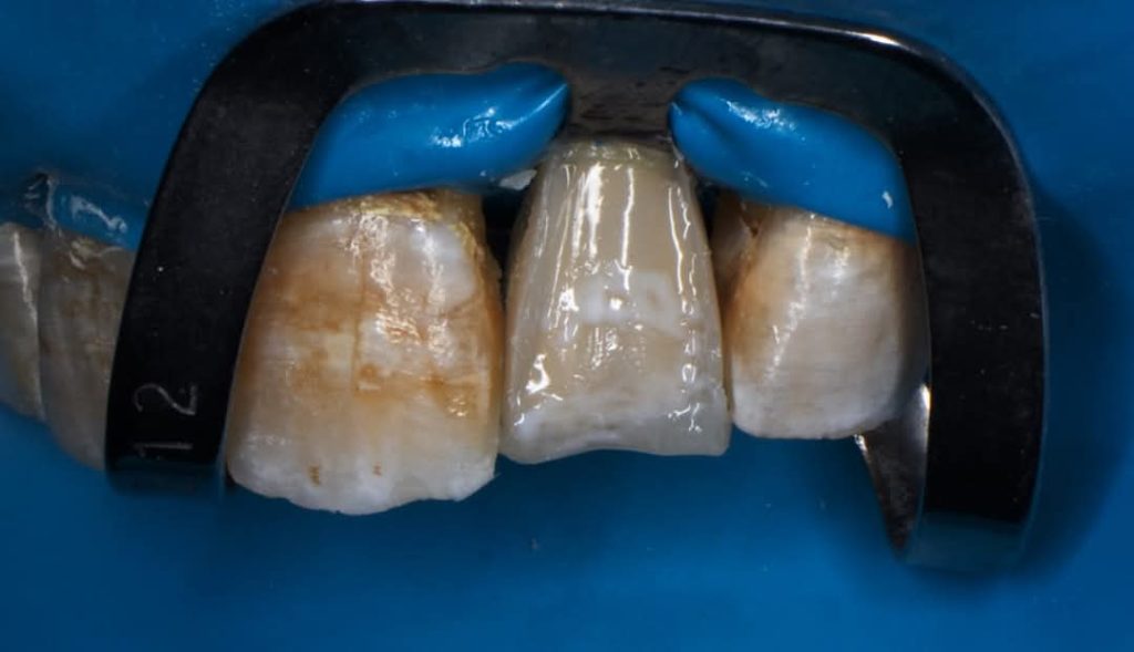 inbound2333303533777615653