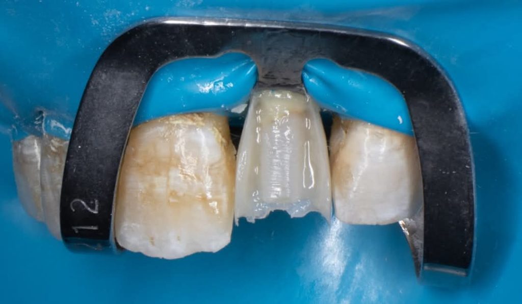 inbound850114351629660106