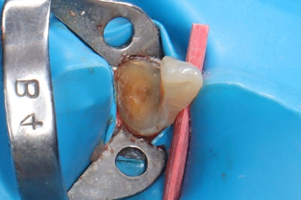 inbound8575107456623459466