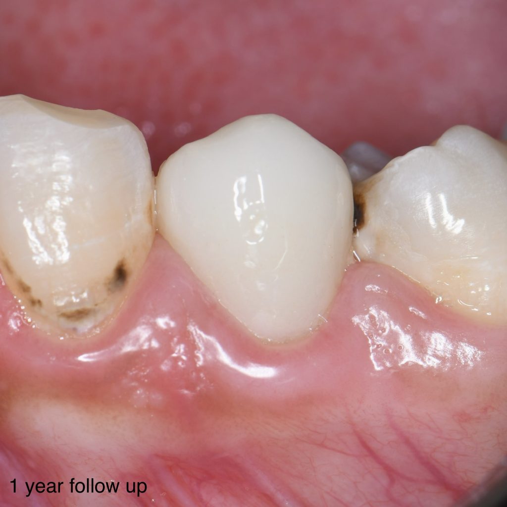 0D078496-1915-448B-ABD2-4677A8C0DE40