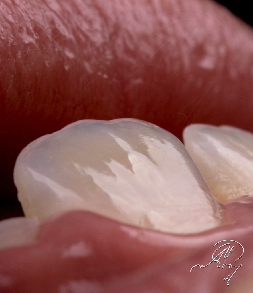 13E5D063-441D-4FE5-93C2-5AC624BEBD0D