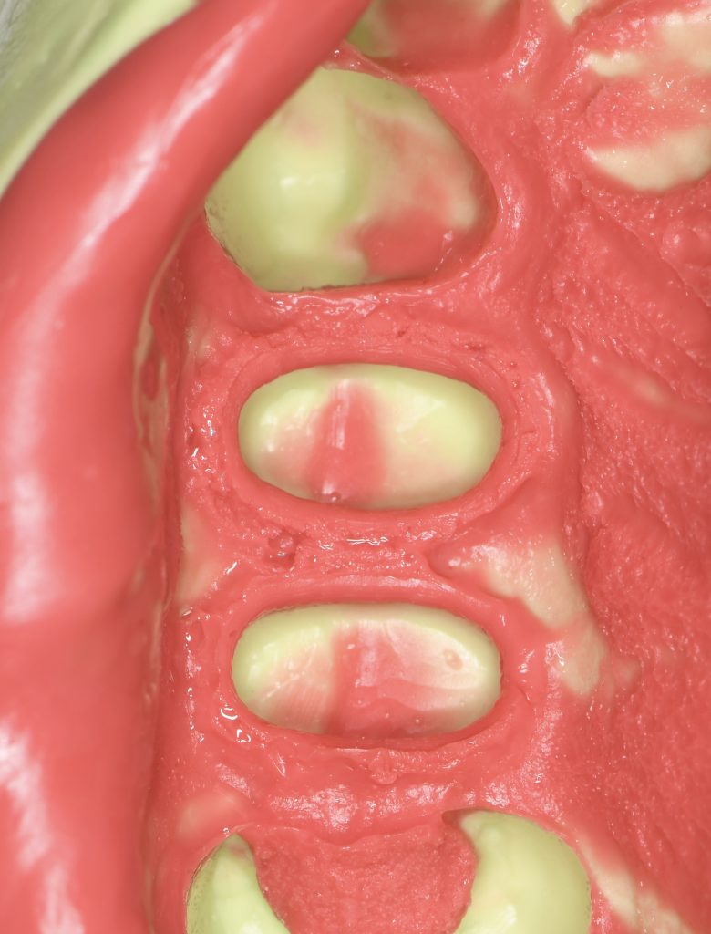 366011F8-7FBF-4D71-B8B6-78F03757AD14