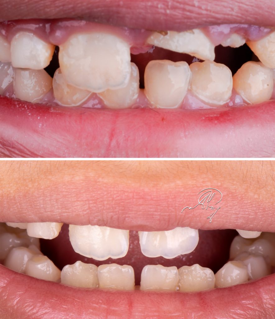 395C8BA5-A8E2-432C-B4FC-0D05FCAABA49