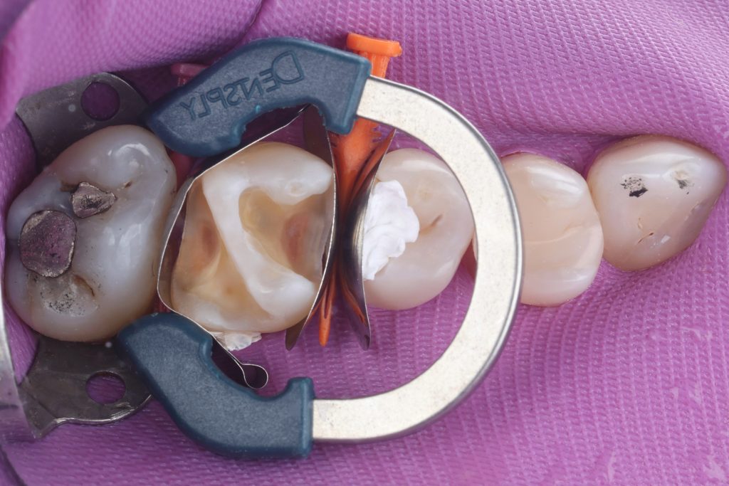 4355C4BA-BAAE-4EEF-AF16-C39AFF632350