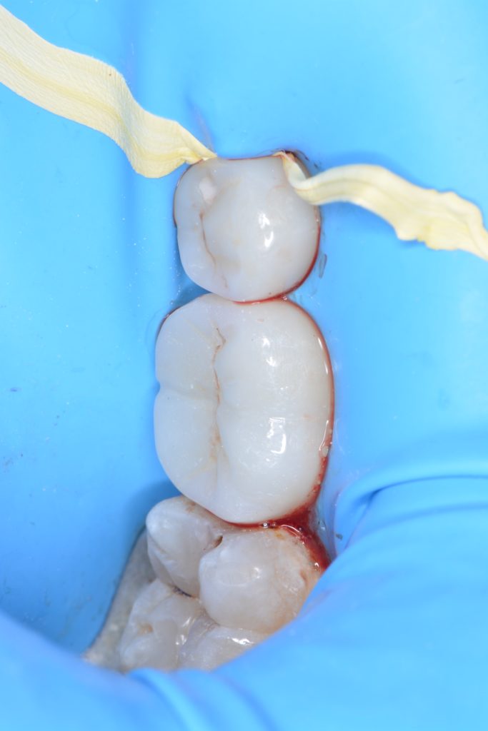 55B86655-0D07-4342-8BCE-5615147630D7