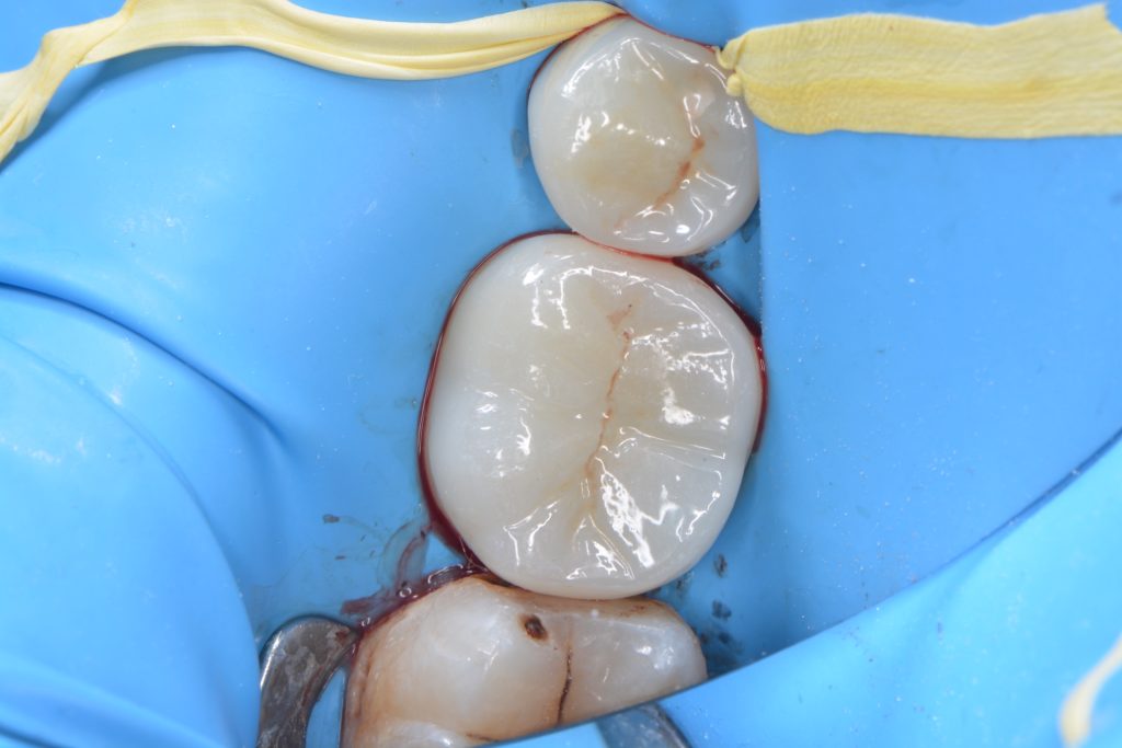 5CD225CA-A9B0-4B84-BD66-F016931C2FEE