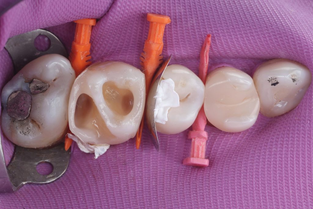 69D3F98C-52A0-4B96-A183-0B1AD4191D4C