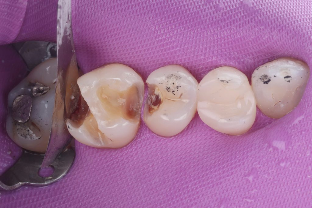 6F20AE5A-303A-40BC-AF48-5DCB81C30970