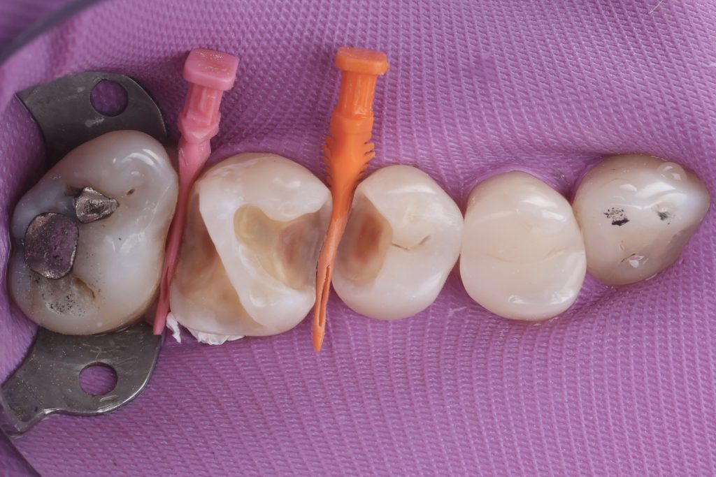 7BE344D4-9305-4B6E-ABAC-EB4463B19D8B