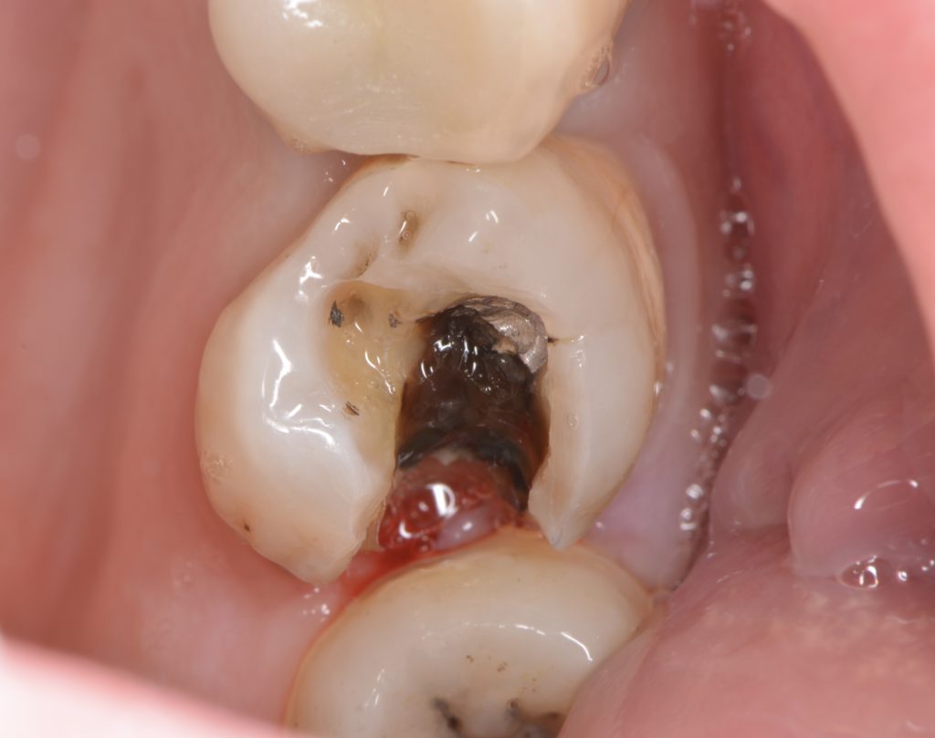 9651018D-36FA-4FB6-8A44-8BB5E394F87A