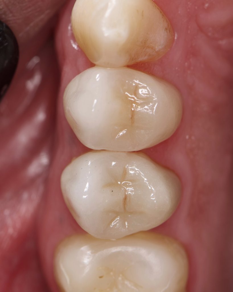 98058ED0-F421-476D-986E-9246C1E1F8D8