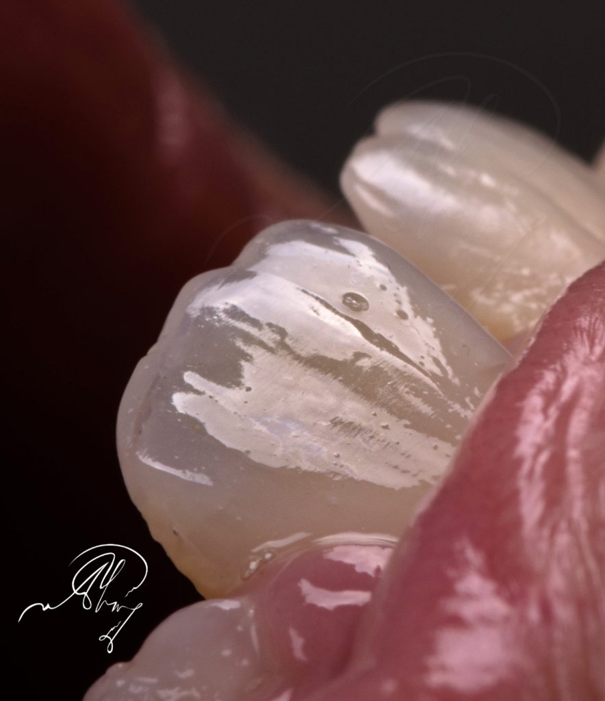 A1D664BB-DBE3-44FF-8A90-D6B185DDA73D